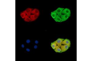 ABIN7096438 and ABIN7100502 staining Hela cells by IF/ICC. (GRAMD1B antibody)