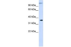Western Blotting (WB) image for anti-Dihydrodiol Dehydrogenase (Dimeric) (DHDH) antibody (ABIN2459844)