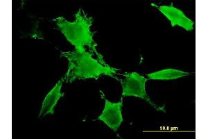 Immunofluorescence of monoclonal antibody to PAK3 on NIH/3T3 cell. (PAK3 antibody  (AA 1-90))