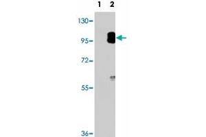 Western blot analysis of PRKG2 (arrow) using PRKG2 polyclonal antibody . (PRKG2 antibody  (C-Term))