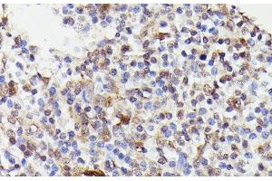 Immunohistochemistry of paraffin-embedded Human tonsil using CDC23 Polyclonal Antibody at dilution of 1:100 (40x lens).