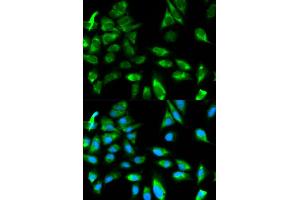 Immunofluorescence analysis of HeLa cells using TRAF6 antibody. (TRAF6 antibody)