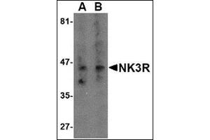 Western blot analysis of NK3R in RAW264. (TACR3 antibody  (Center))
