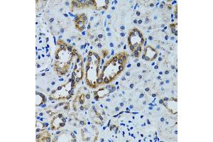 Immunohistochemistry of paraffin-embedded mouse kidney using RPN1 antibody. (RPN1 antibody)