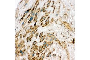 Anti-VEGF Receptor 2 antibody, IHC(F) IHC(F): Human Placenta Tissue (VEGFR2/CD309 antibody  (Middle Region))