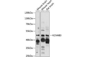 Western blot analysis of extracts of various cell lines, using KCN antibody (ABIN7269483) at 1:1000 dilution.