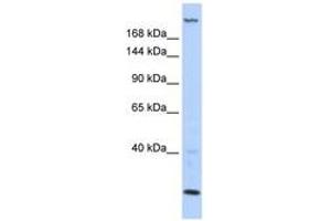 Image no. 1 for anti-Trinucleotide Repeat Containing 6B (TNRC6B) (AA 396-445) antibody (ABIN6743011) (TNRC6B antibody  (AA 396-445))