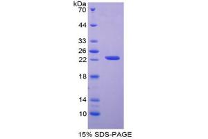 SDS-PAGE analysis of Human APRT Protein. (APRT Protein)