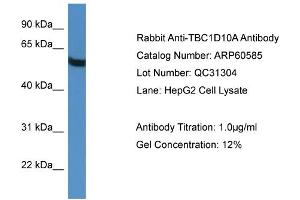 WB Suggested Anti-TBC1D10A  Antibody Titration: 0. (TBC1D10A antibody  (C-Term))