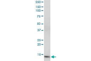 CIDEC monoclonal antibody (M07), clone 2E2. (CIDEC antibody  (AA 53-141))