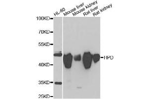 Western blot analysis of extracts of various cell lines, using HPD antibody. (HPD antibody  (AA 1-393))
