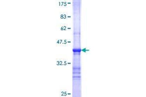 STRN3 Protein (AA 614-713) (GST tag)