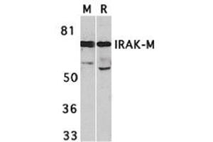 Western Blotting (WB) image for anti-Interleukin-1 Receptor-Associated Kinase 3 (IRAK3) (C-Term) antibody (ABIN1030446) (IRAK3 antibody  (C-Term))