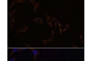 Immunofluorescence (IF) image for anti-Regulator of G-Protein Signaling 4 (RGS4) antibody (ABIN7259747)