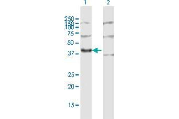 MRPL3 抗体  (AA 1-348)