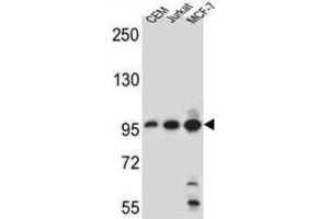 Western Blotting (WB) image for anti-Aftiphilin (AFTPH) antibody (ABIN5022169) (Aftiphilin antibody)