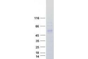 Validation with Western Blot (KLHDC1 Protein (Myc-DYKDDDDK Tag))