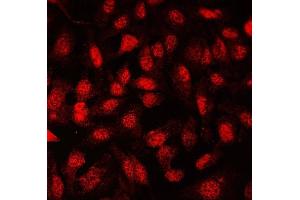 IF analysis of FLI1 using anti-FLI1 antibody (ABIN7599409). (FLI1 antibody  (AA 1-452))