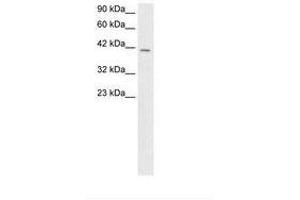 Image no. 1 for anti-SMAD, Mothers Against DPP Homolog 3 (SMAD3) (N-Term) antibody (ABIN202493) (SMAD3 antibody  (N-Term))