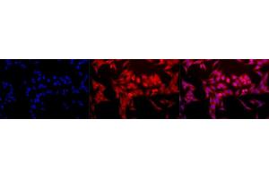 Immunocytochemistry (ICC) image for anti-Heme Oxygenase (Decycling) 1 (HMOX1) antibody (ABIN361674)