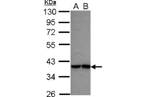 Western Blotting (WB) image for anti-Interferon Regulatory Factor 9 (IRF9) (AA 171-393) antibody (ABIN1498905) (IRF9 antibody  (AA 171-393))