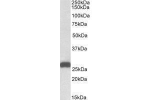 AP21284PU-N ETFB antibody staining of Mouse Liver lysate at 0.