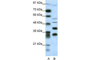WB Suggested Anti-GFI1 Antibody Titration: 0. (GFI1 antibody  (N-Term))