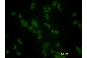 Image no. 3 for anti-Glucosidase, Beta, Acid (GBA) (AA 146-236) antibody (ABIN466020) (GBA antibody  (AA 146-236))