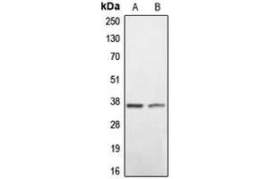 Western blot analysis of BNIP2 expression in HEK293T (A), mouse liver (B) whole cell lysates. (BNIP2 antibody  (C-Term))