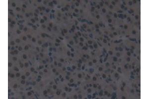 Detection of IRF2 in Mouse Ovary Tissue using Polyclonal Antibody to Interferon Regulatory Factor 2 (IRF2) (IRF2 antibody  (AA 1-349))
