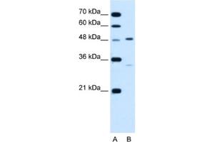 Western Blotting (WB) image for anti-Carbohydrate (Keratan Sulfate Gal-6) Sulfotransferase 1 (CHST1) antibody (ABIN2462855)