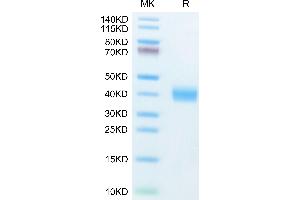Human Galectin 3 on Tris-Bis PAGE under reduced condition. (Galectin 3 Protein (LGALS3) (AA 2-250) (His tag))