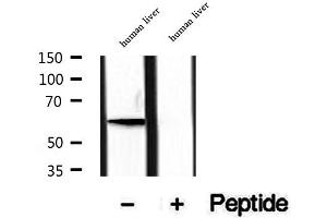Western blot analysis of extracts of human liver tissue, using PIP5K1A antibody.