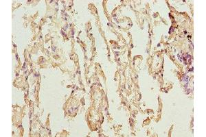 Immunohistochemistry of paraffin-embedded human lung tissue using ABIN7173119 at dilution of 1:100 (TMEM19 antibody  (AA 105-217))