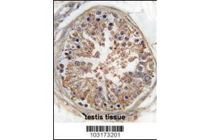 Formalin-fixed and paraffin-embedded human testis tissue reacted with PRKAG1 Antibody , which was peroxidase-conjugated to the secondary antibody, followed by DAB staining. (PRKAG3 antibody  (AA 265-295))