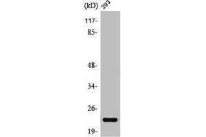 Western Blot analysis of 293 cells using Rab 35 Polyclonal Antibody (RAB35 antibody  (Internal Region))