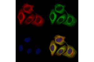 ABIN6264314 and ABIN6274038 staining Hela cells by IF/ICC.