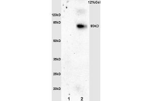 L1 rat brain lysates L2 mouse embryo lysates probed with Anti phospho-N (ABIN762791) at 1:200 overnight at 4 °C. (Nibrin antibody  (pSer343))