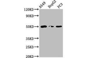 Western Blot Positive WB detected in: A549 whole cell lysate, HepG2 whole cell lysate, PC-3 whole cell lysate All lanes: IFT52 antibody at 5. (IFT52 antibody  (AA 325-434))