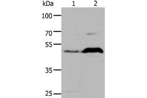 Western Blot analysis of HepG2 cell and Mouse brain tissue using HTR1A Polyclonal Antibody at dilution of 1:1000 (Serotonin Receptor 1A antibody)