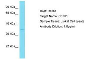 Image no. 1 for anti-Centromere Protein L (CENPL) (AA 108-157) antibody (ABIN6750824) (CENPL antibody  (AA 108-157))