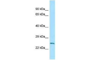 WB Suggested Anti-Rab5a Antibody Titration: 1. (RAB5 antibody  (C-Term))