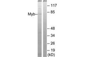 Western blot analysis of extracts from 293 cells, using Myb (Ab-532) Antibody. (MYB antibody  (AA 496-545))