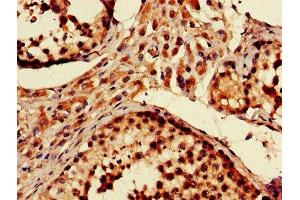 IHC image of ABIN7151093 diluted at 1:600 and staining in paraffin-embedded human testis tissue performed on a Leica BondTM system. (Parkin antibody  (AA 1-465))