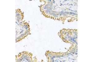 Immunohistochemistry of paraffin-embedded human prostate using RNASE13 antibody at dilution of 1:100 (40x lens). (RNASE13 antibody)
