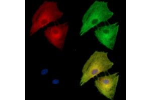 ABIN7095442 and ABIN7099499 staining  cells by IF/ICC.
