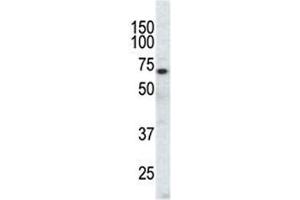 Western Blotting (WB) image for anti-EPH Receptor A3 (EPHA3) (AA 896-928) antibody (ABIN3030820)