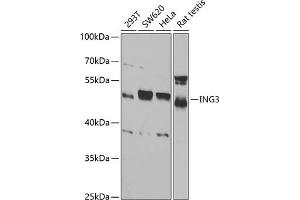 Western blot analysis of extracts of various cell lines, using ING3 antibody (ABIN6128090, ABIN6142450, ABIN6142451 and ABIN6221526) at 1:1000 dilution. (ING3 antibody  (AA 1-92))