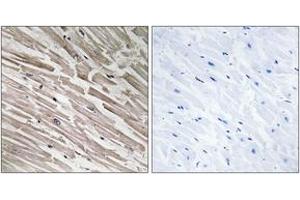 Immunohistochemistry analysis of paraffin-embedded human heart tissue, using MRPL44 Antibody. (MRPL44 antibody  (AA 221-270))