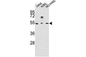 Western blot analysis of APOA4 antibody and Jurkat, K562, NCI-H460 lysate